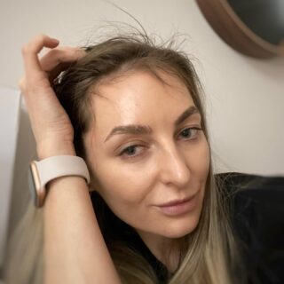 COLLAGEN INDUCTION THERAPY FOR HAIR REGROWTH👱‍♀️
⠀
I would like to share my own experience with you on how I deal with hair loss. This is a very popular question I get from my clients and friends.
In 2019, I started loosing my hair😕 Until today I still do not know the reason for it. I was thinking about stress level, genes, hormones, lack of vitamins and nutrients, or even covid could be the reason for it… I got some test, but never found out the cause🤷‍♀️
✅First, what I did, I stopped getting hair color and cut it off shorter. I start taking vitamins, got the special shampoo and decided to do microneedling with solutions🧪 that has clinical researches and proof.
Approximately six month later, I noticed some difference… My hair stopped falling off, and I start seen growing new hair.
🙂You could see on the picture short, fine hair that is growing in different directions. Its very hard to style it but I do not really care, because I am so happy with results.😃
I am a huge believer in microneedling💉
I already have own proof results after getting microneedling to treat my acne scaring and this time, it helped me with stimulation of hair growth.🧡
⠀
How does collagen induction therapy correct hair loss?
⠀
✔️By stimulating blood flow and increasing availability of cell nutrients and topical medications.
✔️By releasing vascular endothelial growth factor, which improves follicle vascularization, promoting hair growth, and increasing follicle hair size.
✔️By signaling Platelet derived growth factor to interact with the skin of the scalp to promote hair canal formation and growth.
⠀
👉Hair regrowth in the scalp takes a minimum of three months with treatments every 3-4 weeks. Suggested series of six.